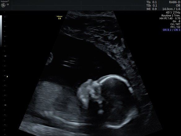 26B6215E-BE10-4E48-B1F0-2FEF82F53BA6